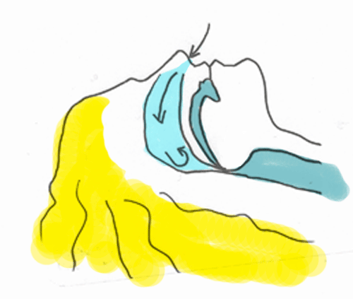 Wirkung einer Schnarchschiene